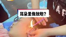 有人说像耳朵抽烟，有人说像耳朵里放鞭炮有争议，但流传多年，舒适的技术项目#采耳培训 #专业釆耳 #培