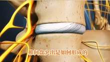 3D动画带你了解椎间盘是如何形成的#体态纠正 #肩颈酸痛 #腰椎间盘突出 #腰痛 #健康脊柱