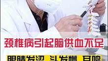 颈椎病引起的脑供血不足有哪些症状？#颈椎病 #健康科普 #医学科普