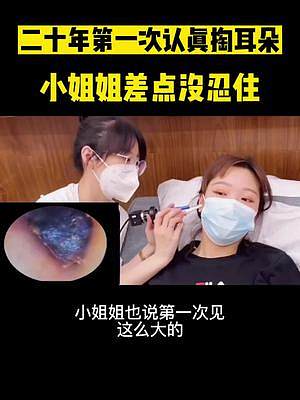 可視化挖耳勺清理耳朵道真解壓，通過手機就能看到耳朵里面的污垢#可視化掏耳勺 #掏耳神器 #咽口水 #