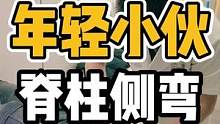 年轻小伙，脊柱侧弯#体态纠正 #脊柱侧弯 #健康 #开启健康2023 #脊柱健康