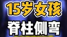 15女孩，脊柱侧弯。寒假在家，家长注意关注一下孩子的脊柱健康#体态纠正 #开启健康2023 #健康 