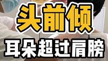 头前倾，耳朵超过肩膀#体态纠正 #头前倾 #开启健康2023 #健康 #颈椎