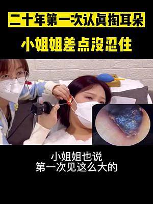 可視化挖耳勺清理耳朵道真解壓，通過手機(jī)就能看到耳朵里面的污垢#可視化掏耳勺 #掏耳神器 #咽口水 #