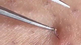 這根毛拔的很謹(jǐn)慎