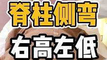 脊柱侧弯，右高左低#脊柱侧弯 #体态纠正 #开启健康2023 #脊柱 #高低背