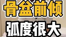 骨盆前倾，弧度很大#开启健康2023 #肩颈酸痛 #体态纠正 #腰酸背痛 #骨盆前倾
