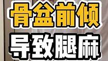 骨盆前倾，导致腿麻#开启健康2023 #骨盆前倾 #腰酸背痛 #体态调整 #健康