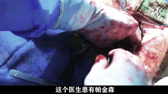 医生患有帕金森，却隐瞒病情给患者做手术，结果意外发生了！