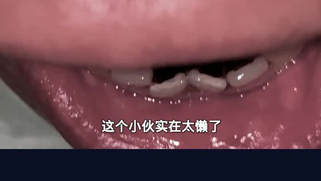 这一口的牙真是美的让人窒息，难怪可以臭晕千万少女！