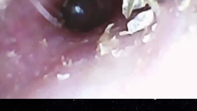 挖耳朵到底有多舒服，看看挖耳朵有多解压