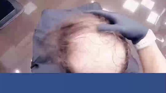 你还知道什么方法？