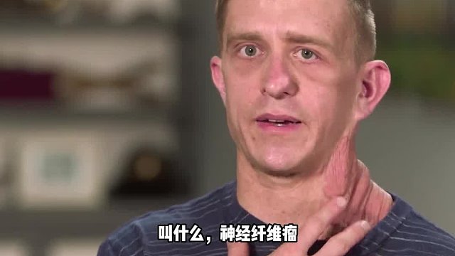 男子因为从小有皮肤病，长期以来一直被人排挤，到底怎么回事！