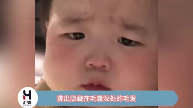 挑出隐藏在毛囊深处的毛发，是谁龇牙咧嘴的看完了