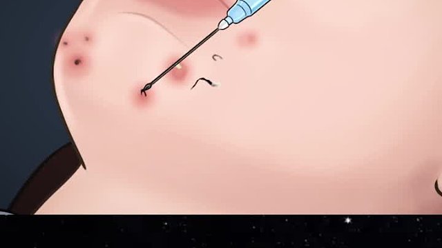 四年没洗澡的话会有多脏，这个视频将告诉你！