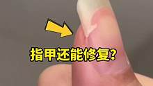 被撕开的指甲竟然还能够修复，强迫症舒服了 #美甲 #强迫症必看 #指甲修复