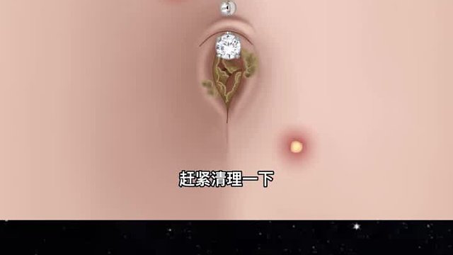 美女长期没洗澡，导致肚脐里面填满了脏东西
