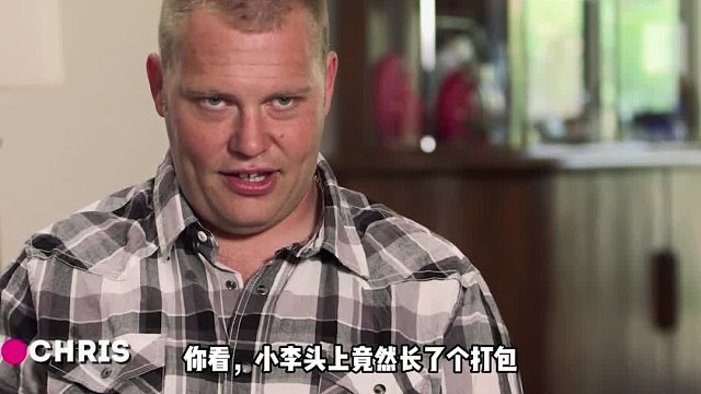 男子头顶长了一个小包，被女友嫌弃是怪物，到底怎么回事！