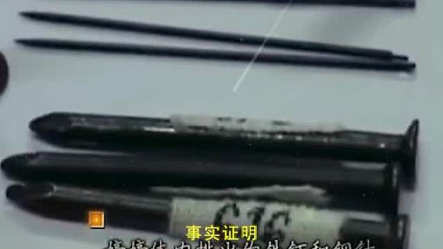 陕西1岁女童体内不断冒出铁钉，反复生长，得出真相后医生不接受了