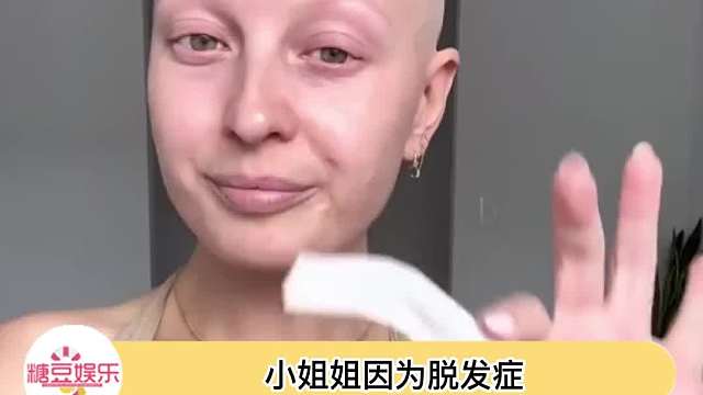 小姐姐因为脱毛症掉光了所有毛发……可是她光头也好漂亮