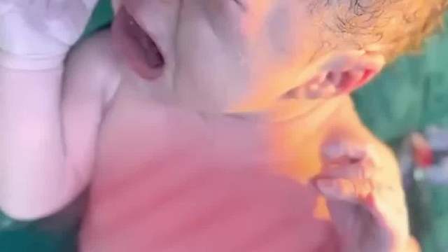 宝宝在妈妈肚子太调皮了，结果被各种绕手绕脚