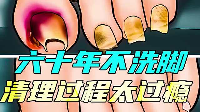 女孩六十年不洗脚，味道堪比生化武器，清理过程真过瘾 