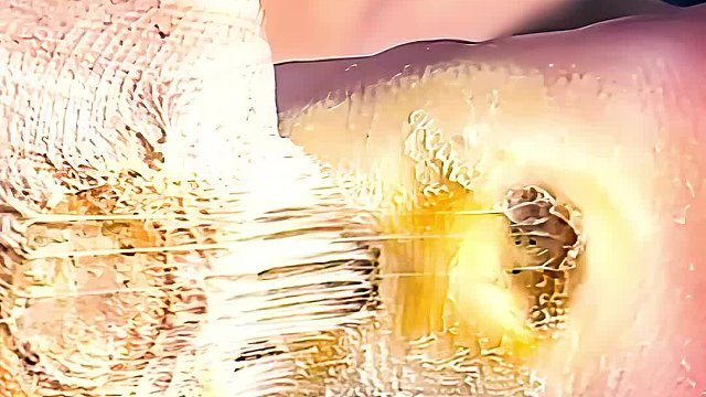 男人太穷想吃肉，竟然用脚饲养寄生虫，清理过程好过瘾