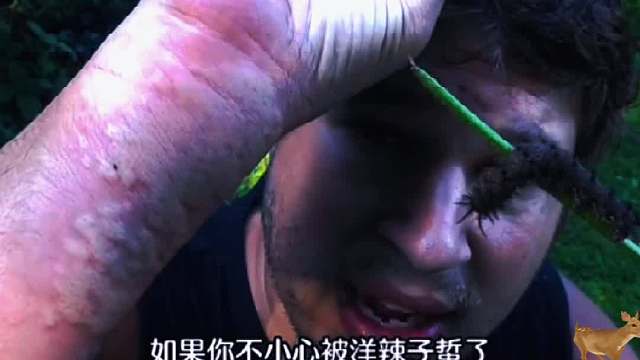 被辣子蜇快速解决的办法