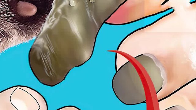 小李子竟十年不修脚指甲，脱下鞋惊呆众人，经历过程好解压