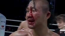 KO日本冠军，踢裂眉骨血流如注，扔白毛巾认输，一龙也佩服他！ 
#格斗 #自由搏击 #mma综合格斗