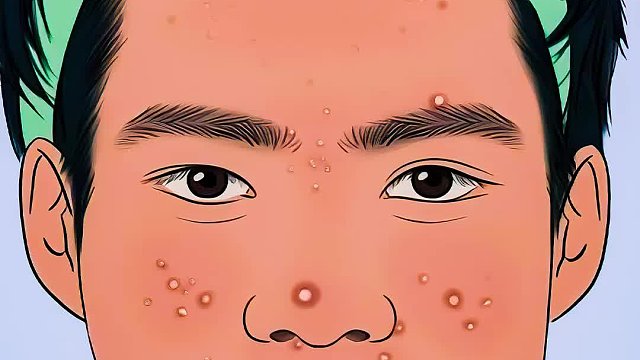 饺子吃进去从脸上冒出来，痛苦不堪，清理过程超解压