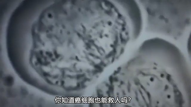 癌细胞也能救人？已故黑人妇女的癌细胞，70年拯救数10亿人！
