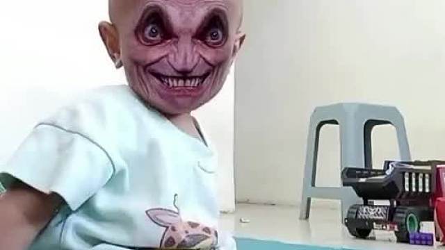 童年的心理阴影。