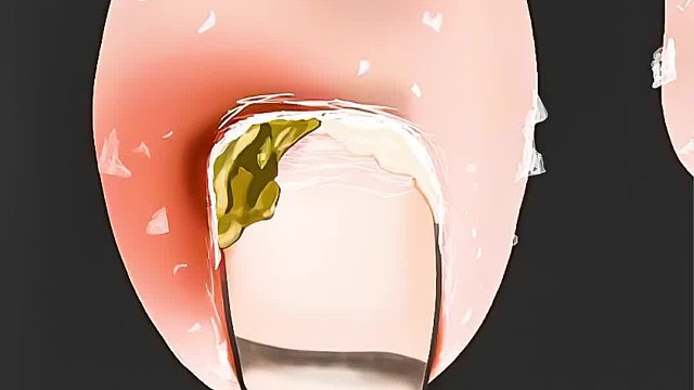 女人三年不洗脚，竟熏死家里宠物狗，清理过程超解压