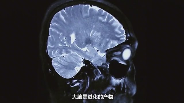 人的大脑，有哪些天生的设计缺陷？