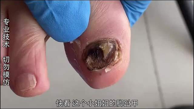 纪录片：像牛肉干的脚趾甲，是牛肉出了轨还是脚趾头劈了腿？