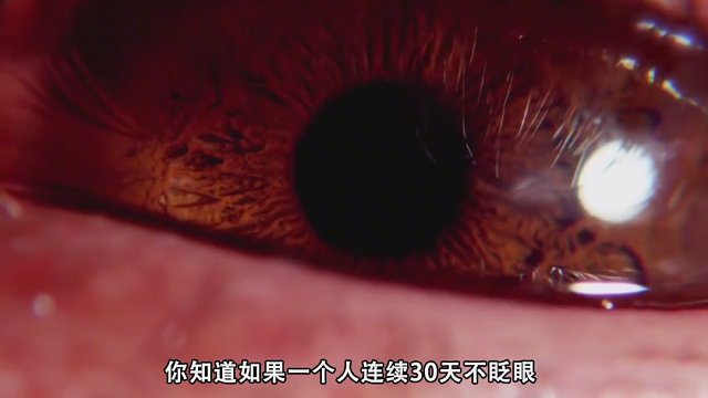 如果一个人连续30天不眨眼，会变成瞎子吗？