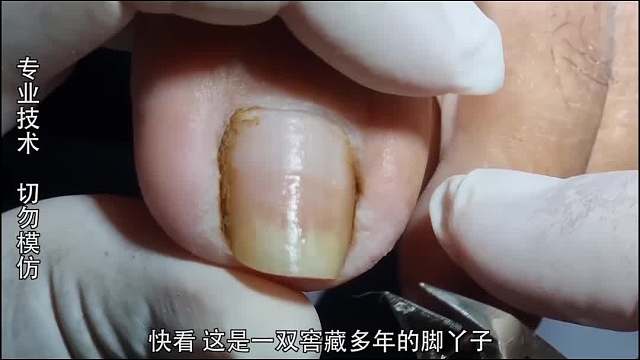 纪录片：窖藏多年的脚丫子，竟然不被修脚师傅重视！