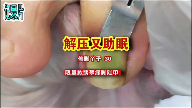 纪录片：限量款翡翠绿脚趾甲！