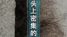 石头上密密麻麻的腿，怎么回事？#给孩子看的小知识 #给孩子看世界 
