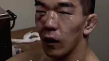 格斗史上最狠的男人，开局就被戳瞎眼睛，竟连胜两位200斤壮汉
