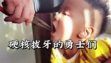 盘点硬核拔牙的勇士们，每一个都是童年的恶魔#拔乳牙 #熊孩子 #看着都痛 #搞笑