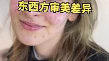 雀斑脸，宽下颌，削鼻子，东西方审美差异有多大 #审美差异 #雀斑 #美颜