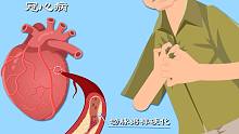冠心病1：手麻竟是心脏有问题？