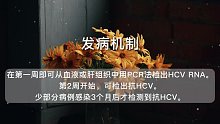 急性肝炎(34)