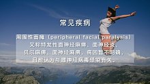 周围性面瘫