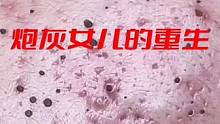 #鬼知道我看了多少遍 #解压挤痘痘 #强迫症治愈系 #挤痘贼爽 #超爆小故事合集
