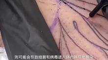 纹身的工作原理太可怕了