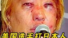 打人专门打脸!美国选手打日本选手，狂轰百拳效果堪比整容！ #拳击比赛 #综合格斗 #散打王 #拳击 