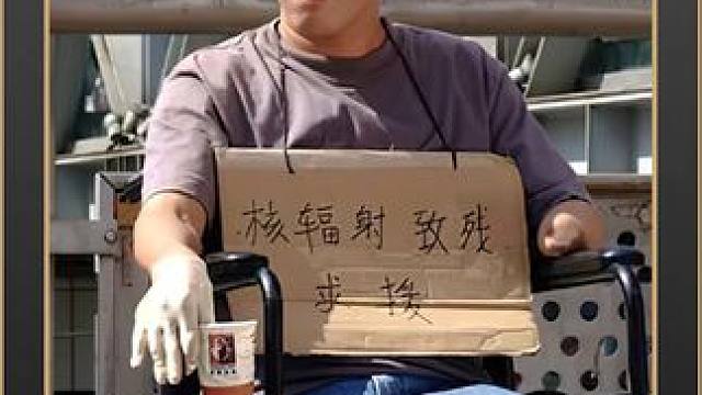 世界上最可怕的不治之症，国内首个核辐射受害者，被切了半个身体 #影视解说 #真实事件